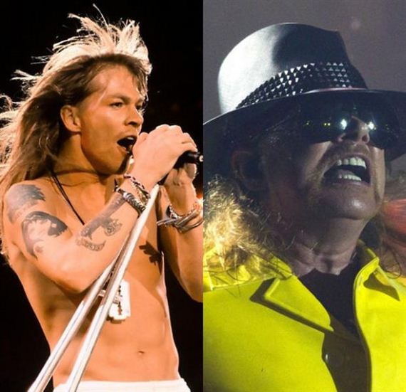 Axl Rose Before and After