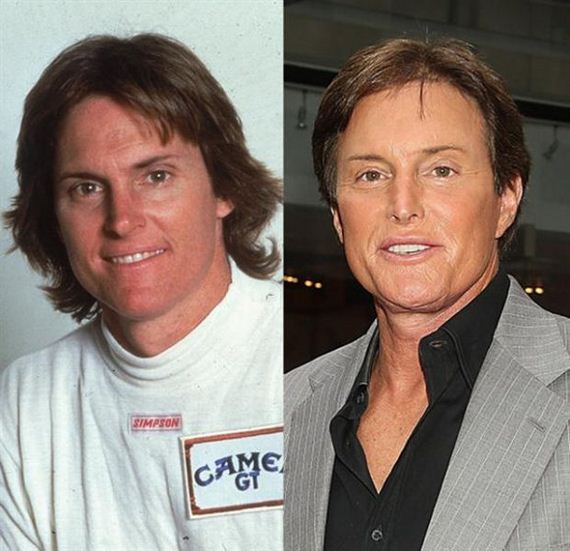 Bruce Jenner Before and After