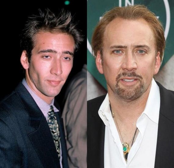 Nicholas Cage Before and After