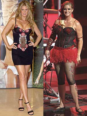 Rachel Hunter Before and After