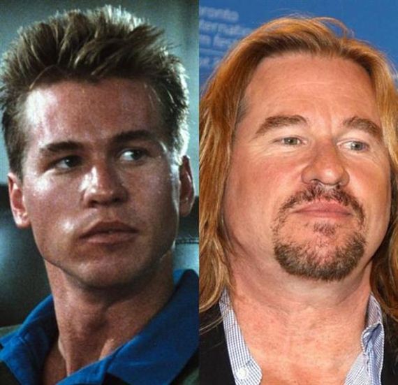 Val Kilmer - Before and After